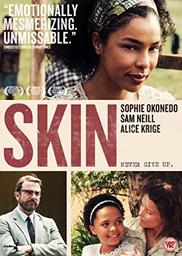 Skin / film de Anthony Fabian | Fabian, Anthony. Monteur